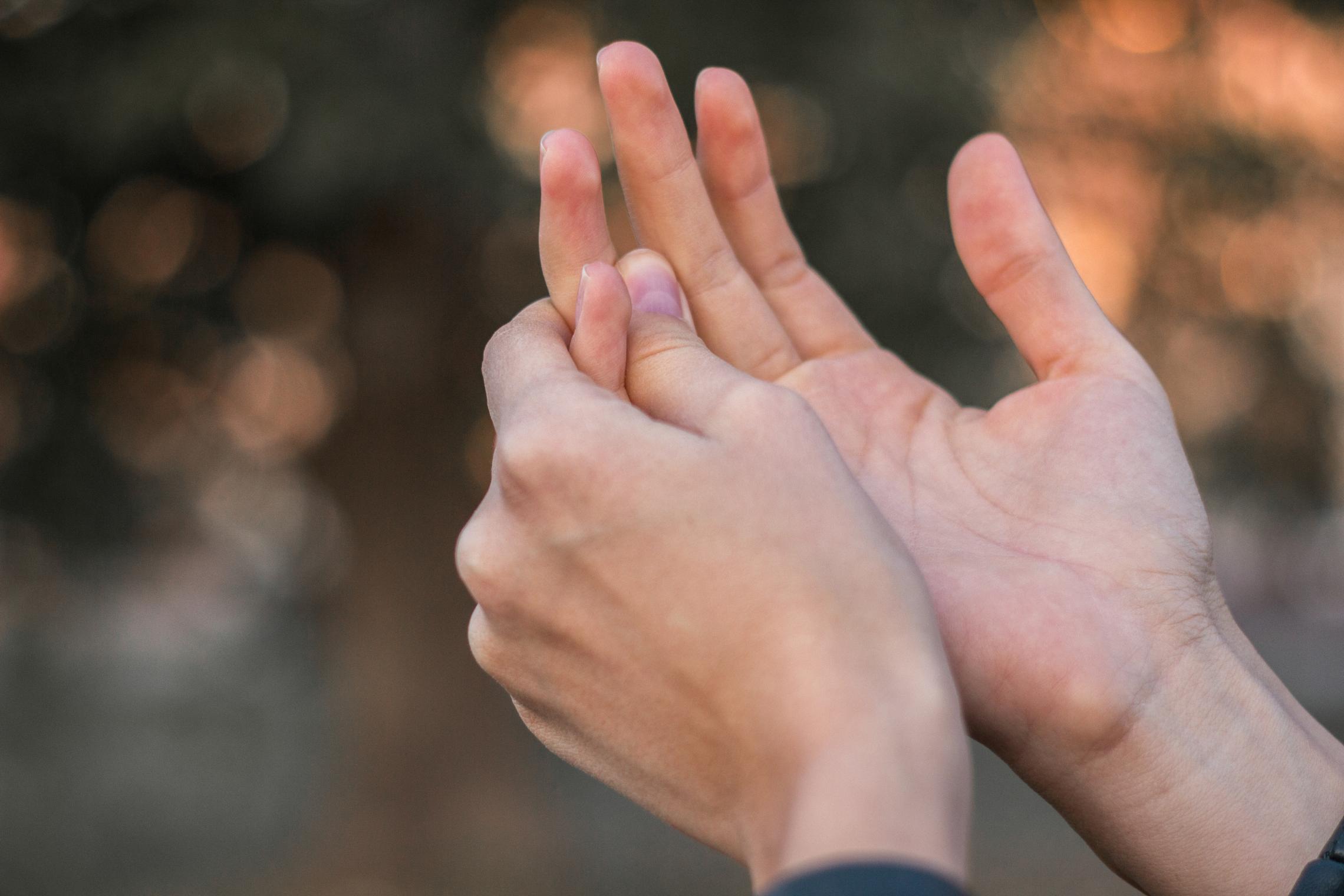 Frau mit Psoriasis-Arthritis an den Fingern. Diese schmerzen, sind geschwollen und steif.